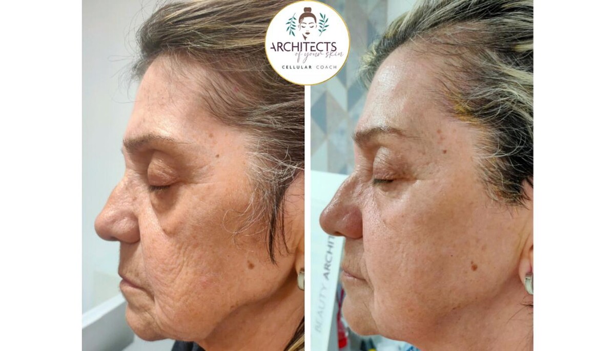 Images Estetic Natura - Centro de Estética Integral Avanzada en Barcelona