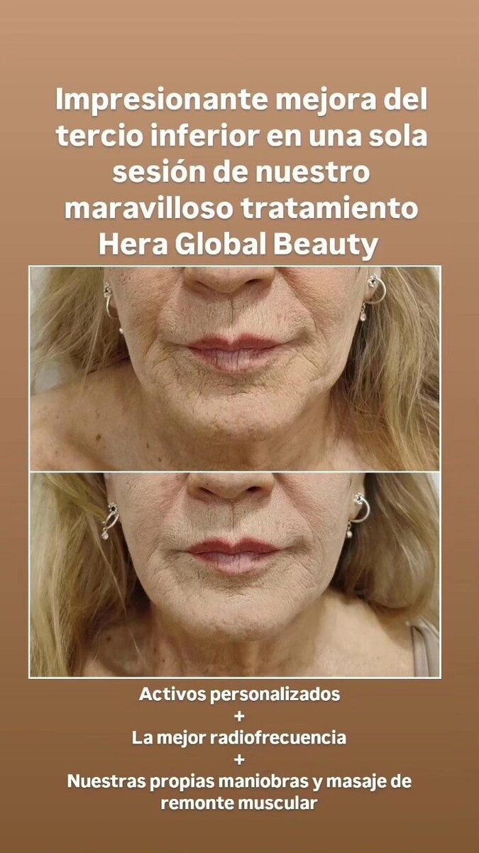 Images Estetic Natura - Centro de Estética Integral Avanzada en Barcelona