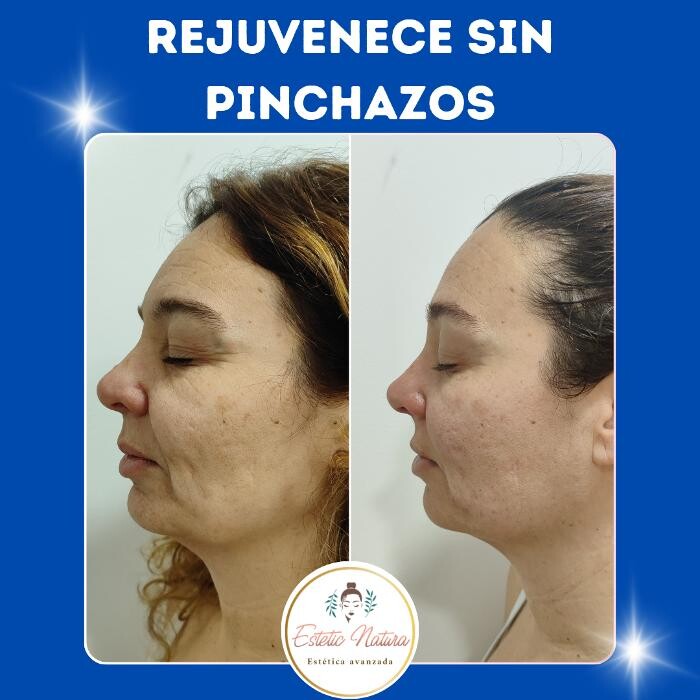 Images Estetic Natura - Centro de Estética Integral Avanzada en Barcelona