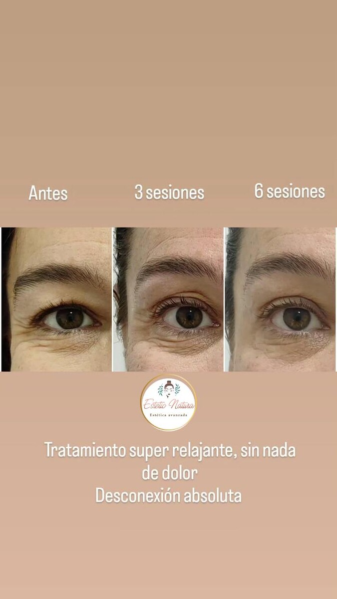 Images Estetic Natura - Centro de Estética Integral Avanzada en Barcelona