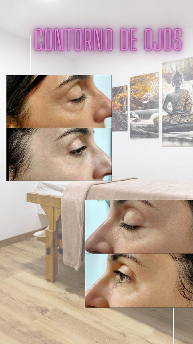 Images Estetic Natura - Centro de Estética Integral Avanzada en Barcelona