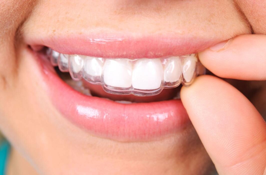 Images Clínica dental Vall Hebrón