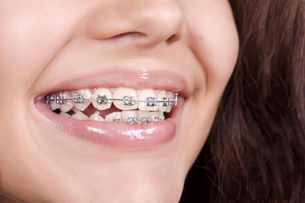 Images BONESTAR CLÍNICA DENTAL