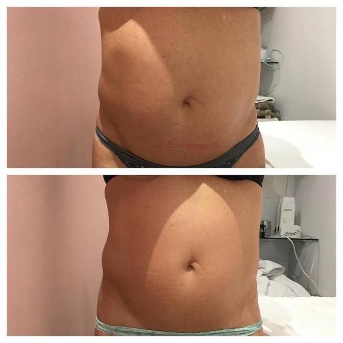 Images LC Castelar Centro De Estética Y Uñas Esculpidas