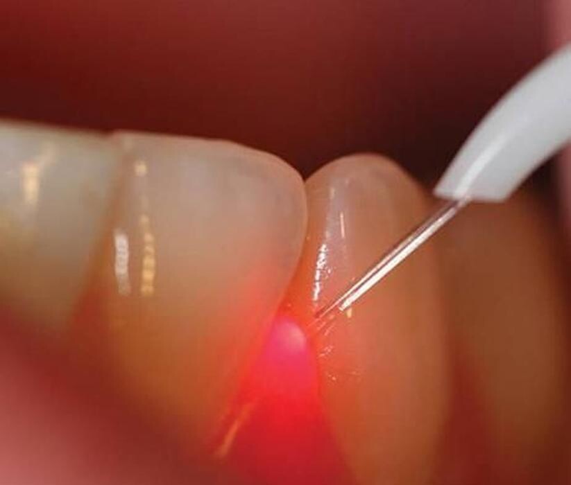Images Clínica Dental Icaria