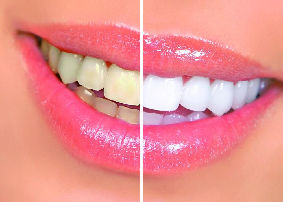 Images Clínica Dental Icaria