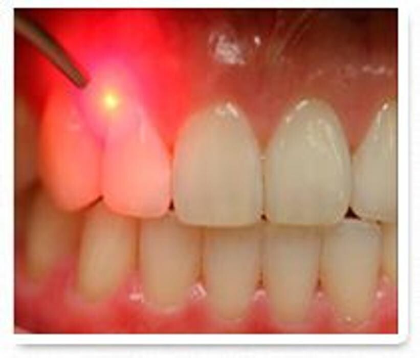 Images Clínica Dental Icaria