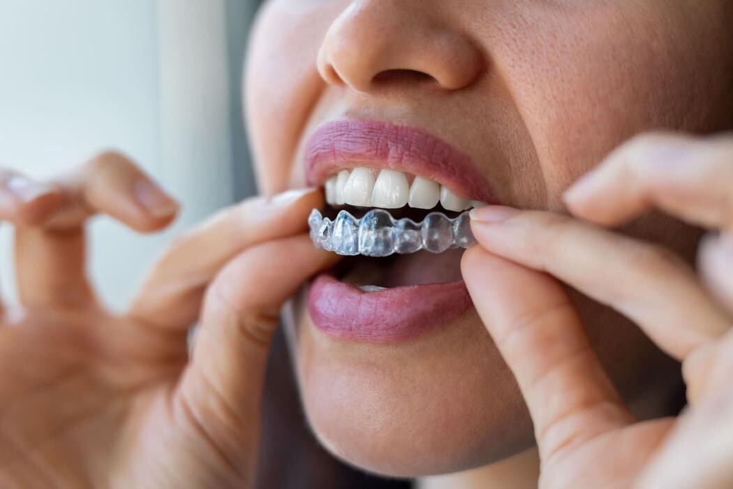 Images Clínica Dental Icaria