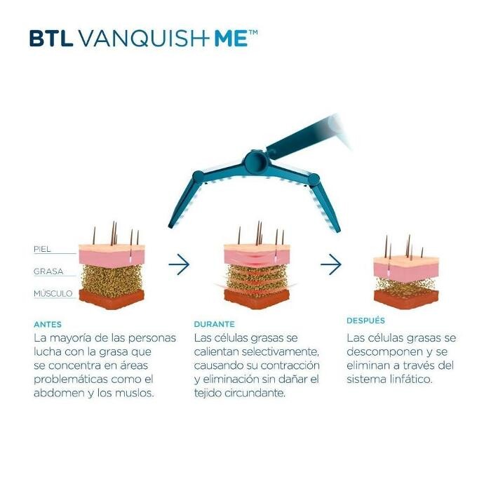 Images Estética Sara González