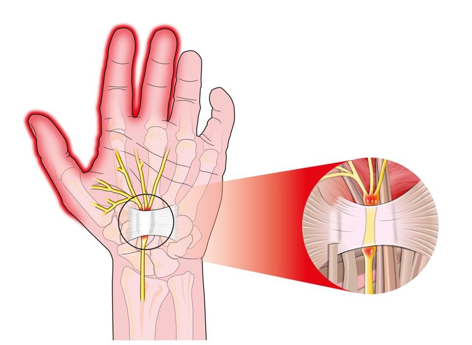 Images Chirurgie de la Main et de l'épaule
