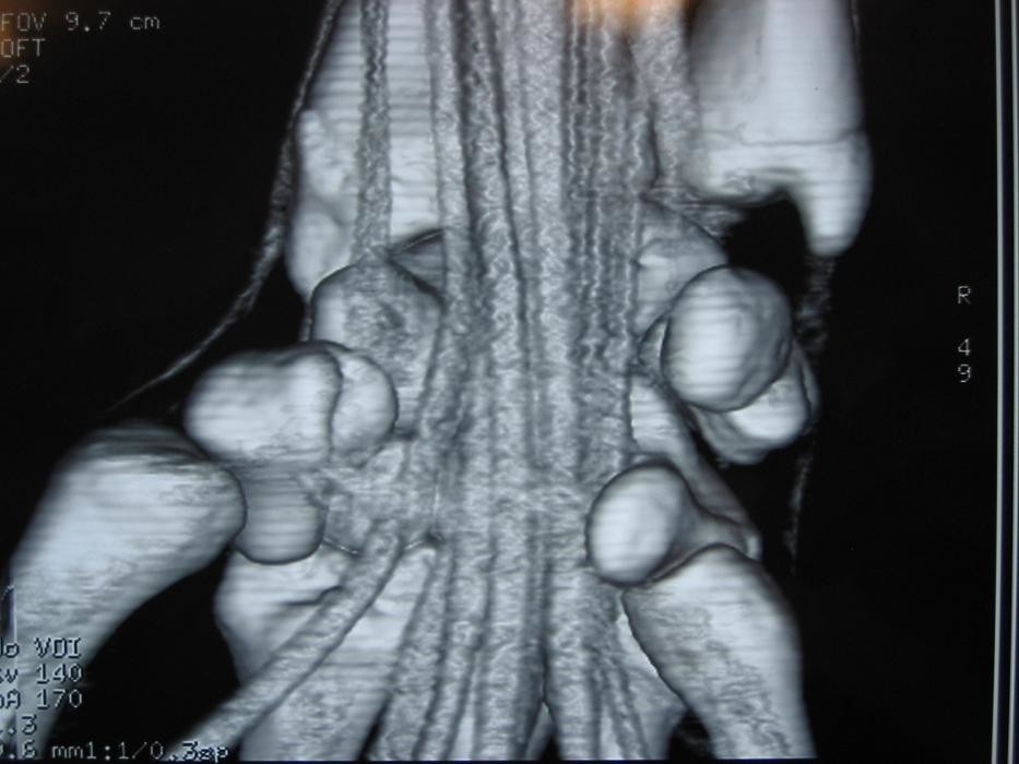 Images Chirurgie de la Main et de l'Épaule