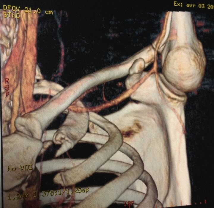 Images Chirurgie de la Main et de l'Épaule