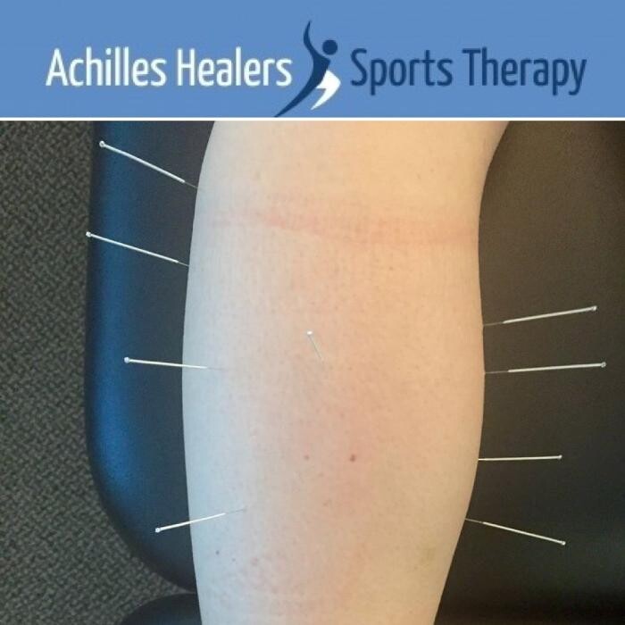 Images Achilles Healers Sports Therapy