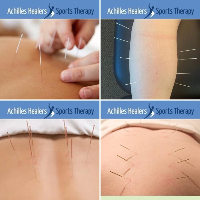 Images Achilles Healers Sports Therapy