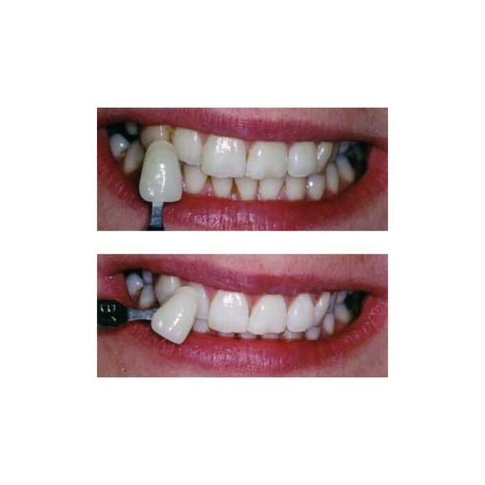 Images 57 Friar Gate Dental Practice