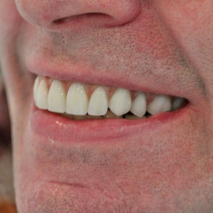 Images Shergill Dental Implants - Birmingham