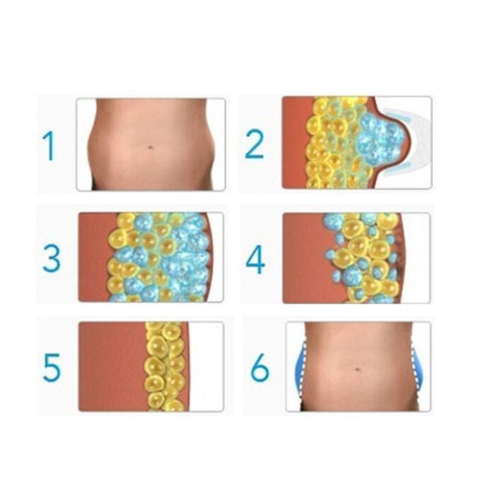Images Ice Lipo in Plymouth, Put The Diet On Ice.