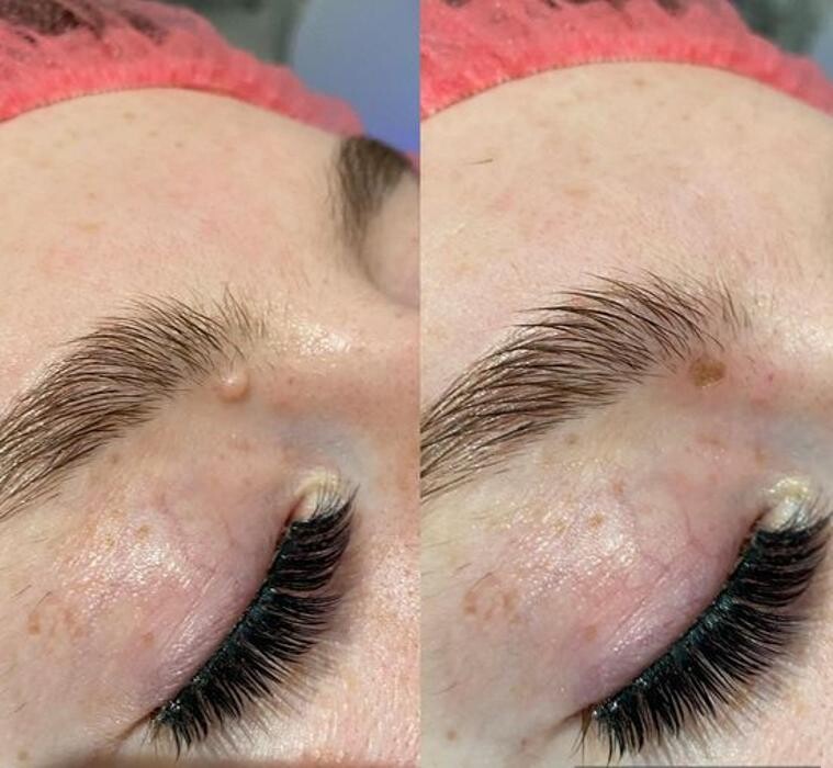 Images High Grade House Skin Clinic