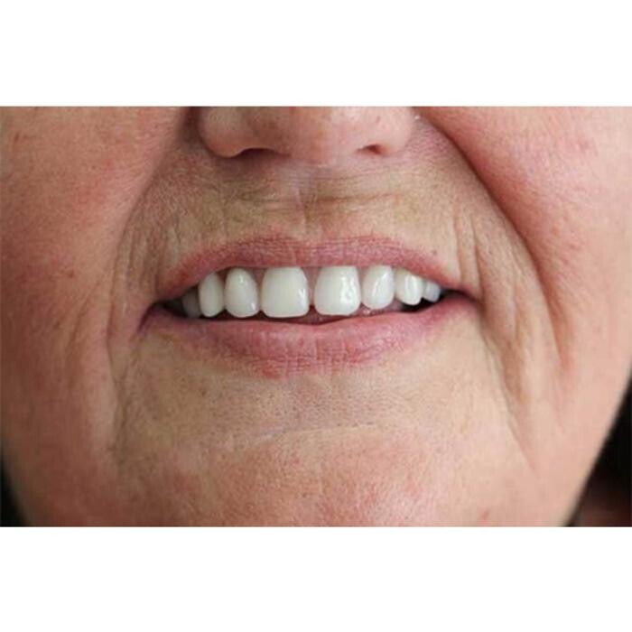 Images Broad Lane Dental Surgery