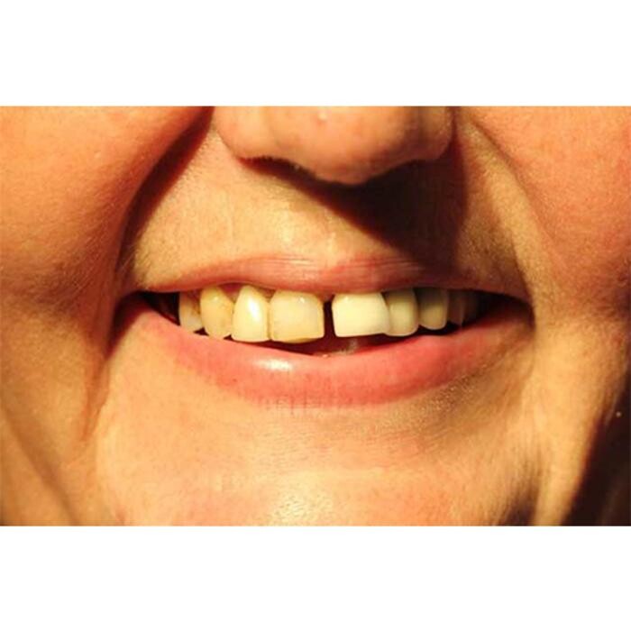 Images Broad Lane Dental Surgery