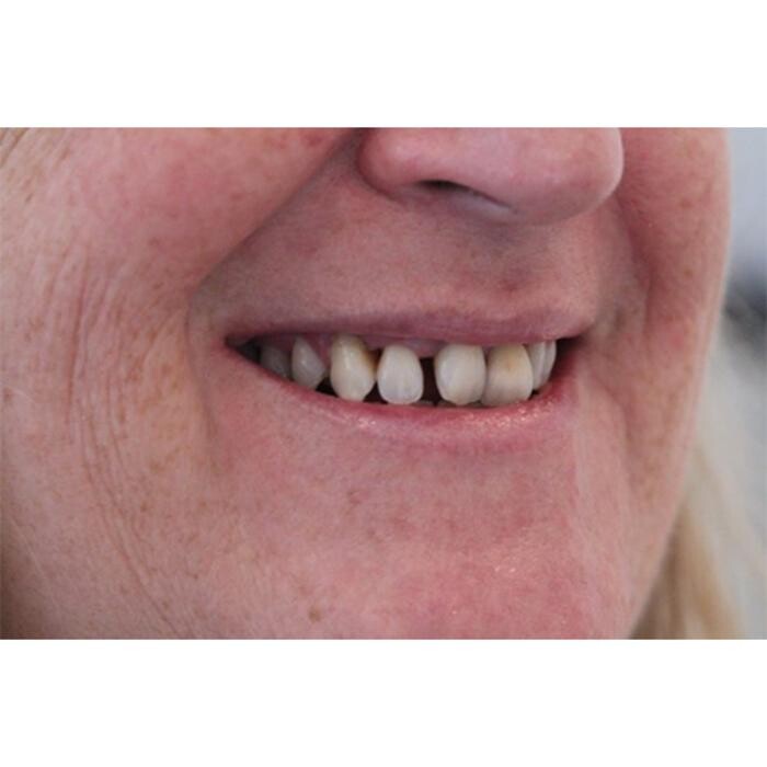 Images Broad Lane Dental Surgery