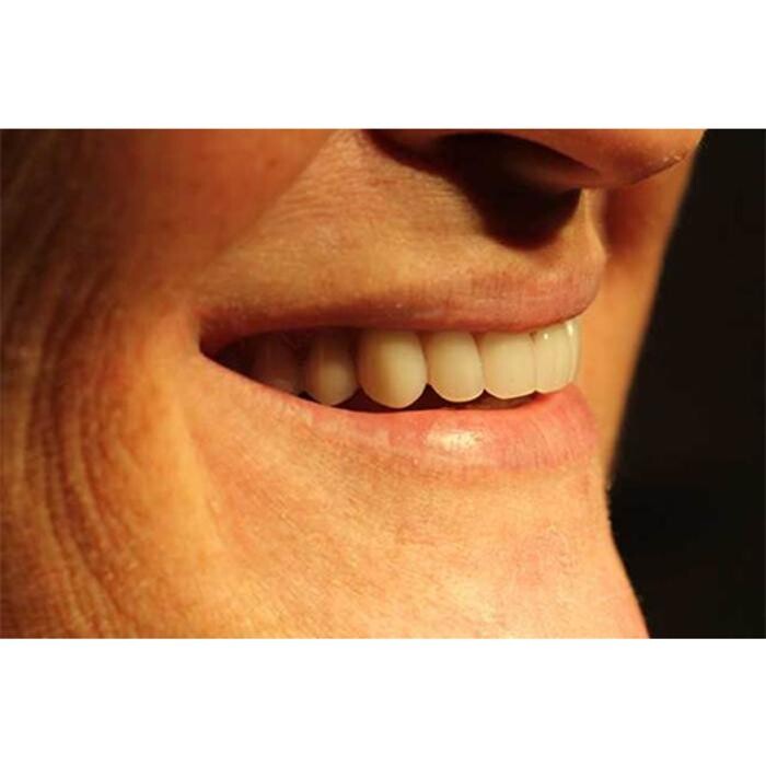 Images Broad Lane Dental Surgery