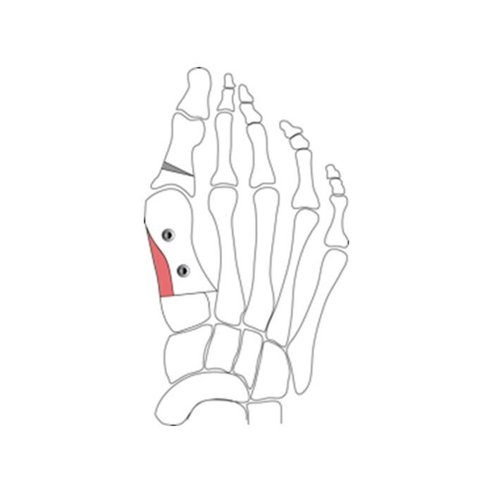 Images Michael O'Neill - Fix My Foot