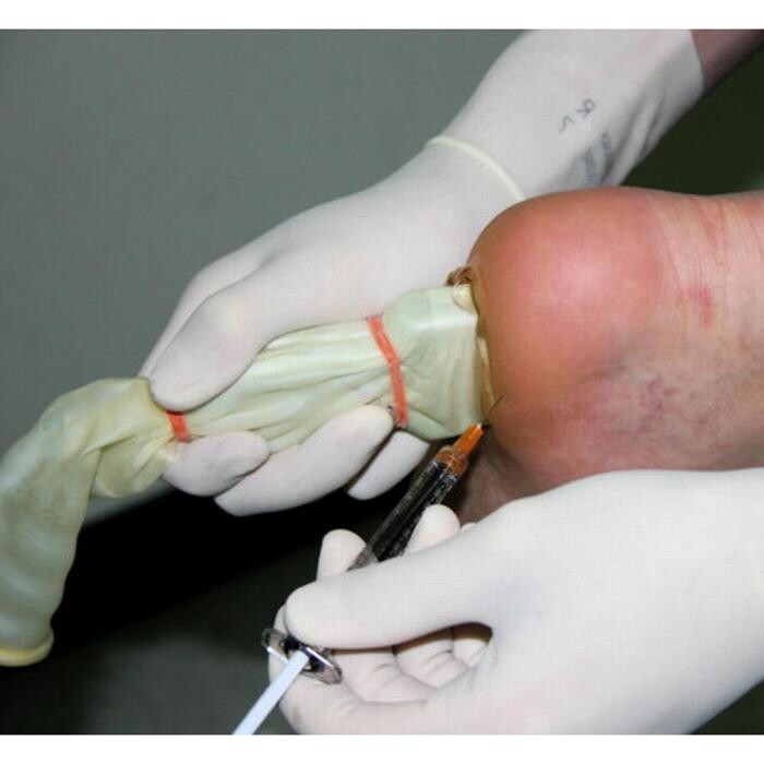 Images Michael O'Neill - Fix My Foot