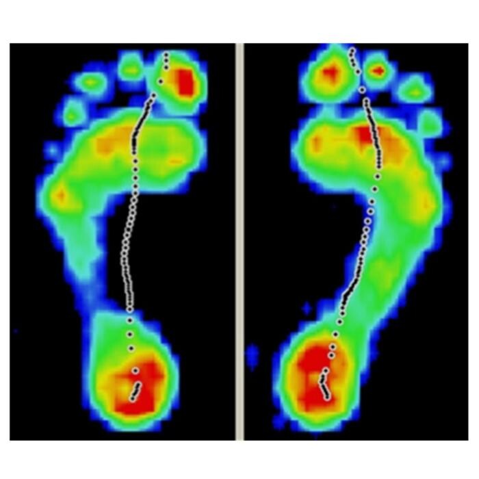 Images Michael O'Neill - Fix My Foot