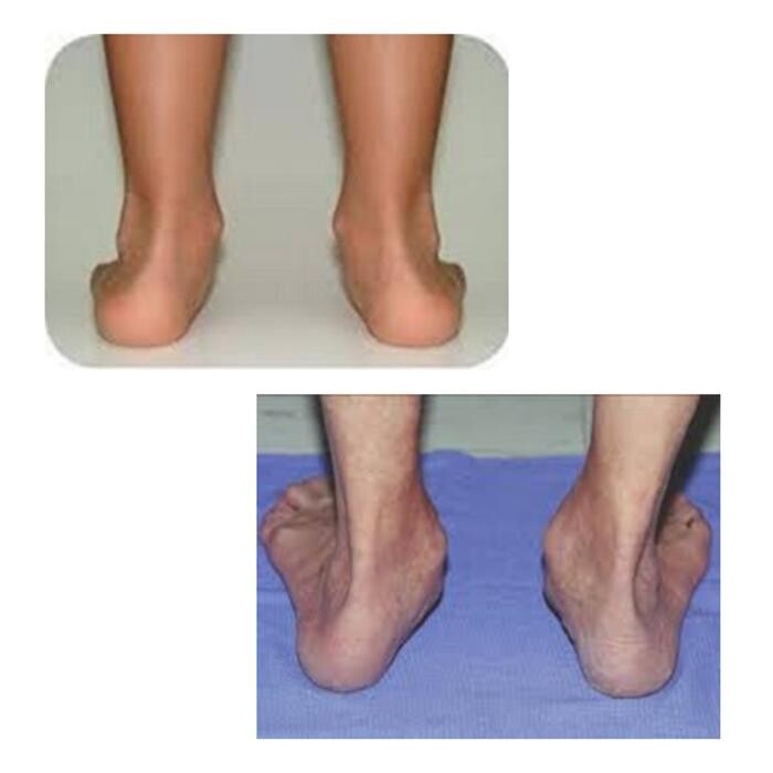 Images Michael O'Neill - Fix My Foot