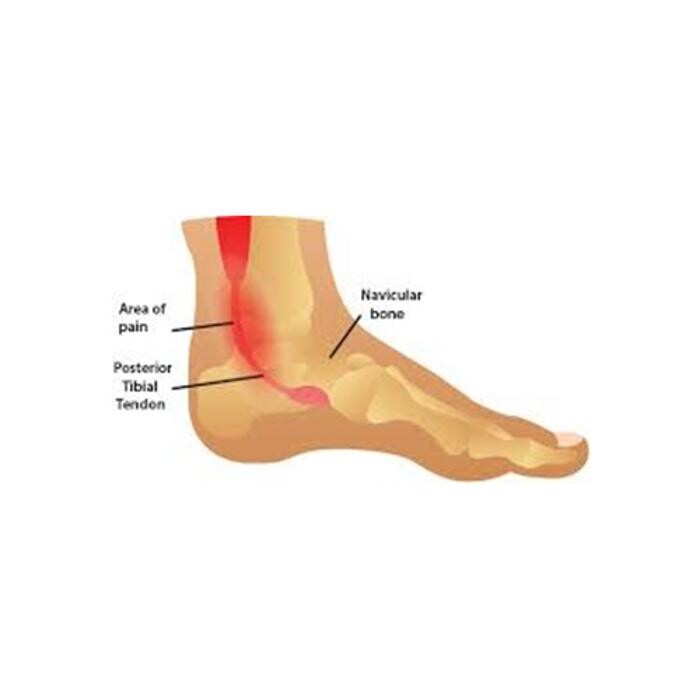 Images Michael O'Neill - Fix My Foot