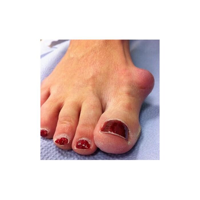 Images Michael O'Neill - Fix My Foot