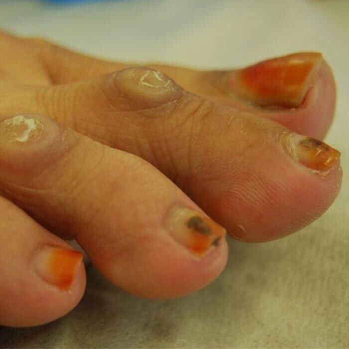 Images Michael O'Neill - Fix My Foot