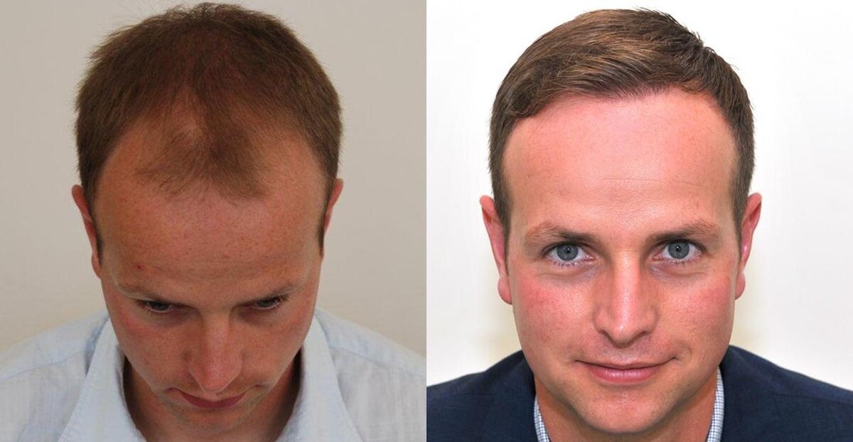 Images HAIRWORLD MARMARA