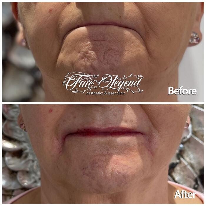 Images True Legend Aesthetics & Laser Clinic