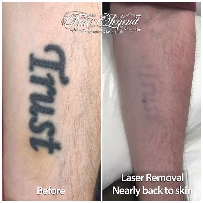 Images True Legend Aesthetics & Laser Clinic