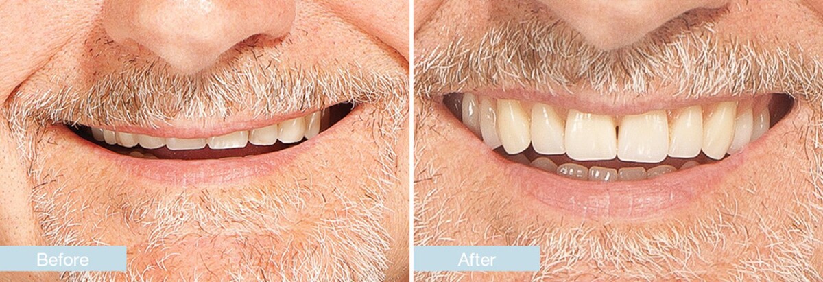 Images Changing Faces Dentures, Chichester & Worthing, Sussex