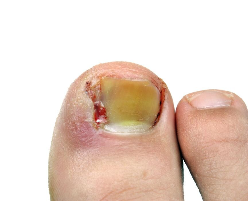 Images Tennant Podiatry