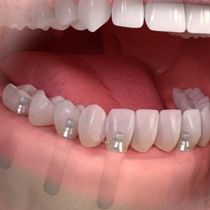Images WS4 Dental Care