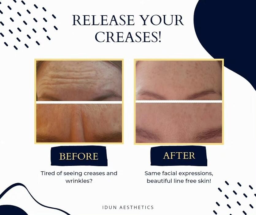 Images Idun Aesthetics