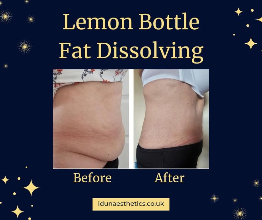 Images Idun Aesthetics