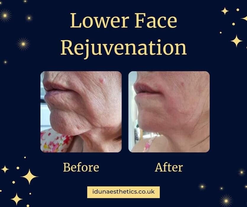 Images Idun Aesthetics