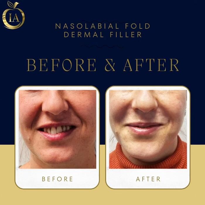 Images Idun Aesthetics