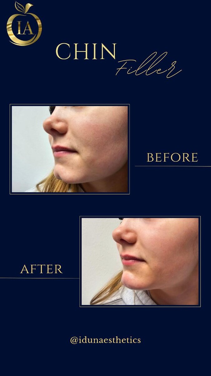 Images Idun Aesthetics