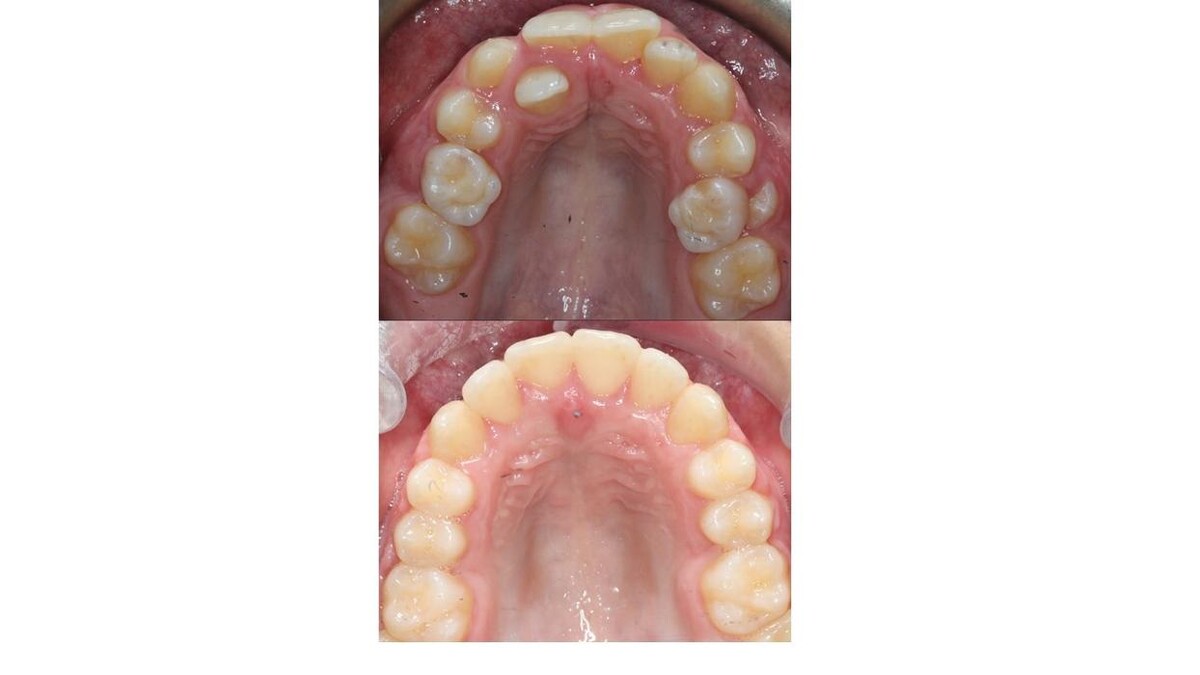 Images mydentist, Beverley Orthodontic Centre, Norwood, Beverley
