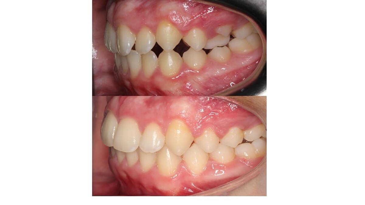 Images mydentist, Beverley Orthodontic Centre, Norwood, Beverley