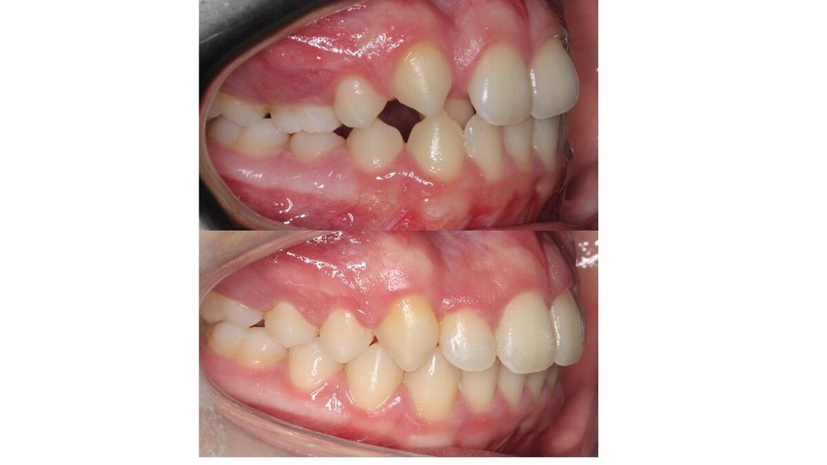 Images mydentist, Beverley Orthodontic Centre, Norwood, Beverley