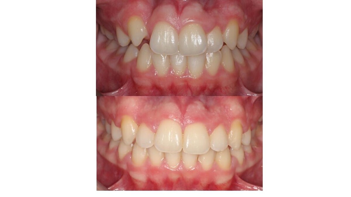 Images mydentist, Beverley Orthodontic Centre, Norwood, Beverley