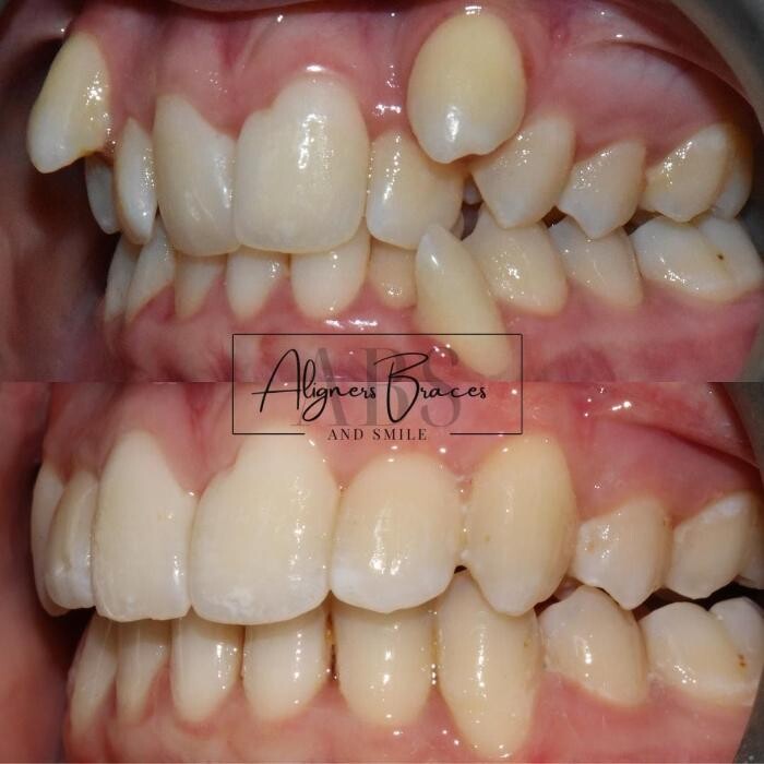 Images mydentist, Bristol Orthodontics, Kingswood, Bristol