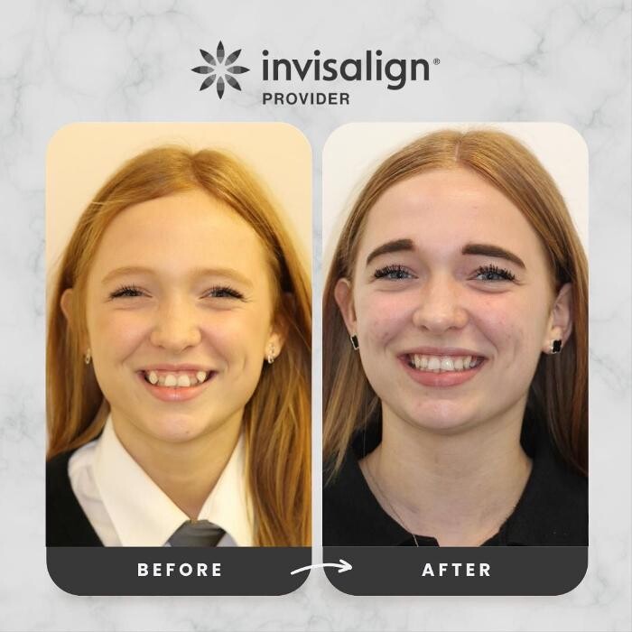 Images mydentist, Bristol Orthodontics, Kingswood, Bristol